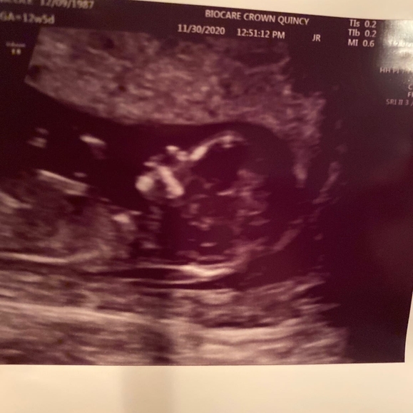 Meet your Posher, Diane - Picture 1 of 1